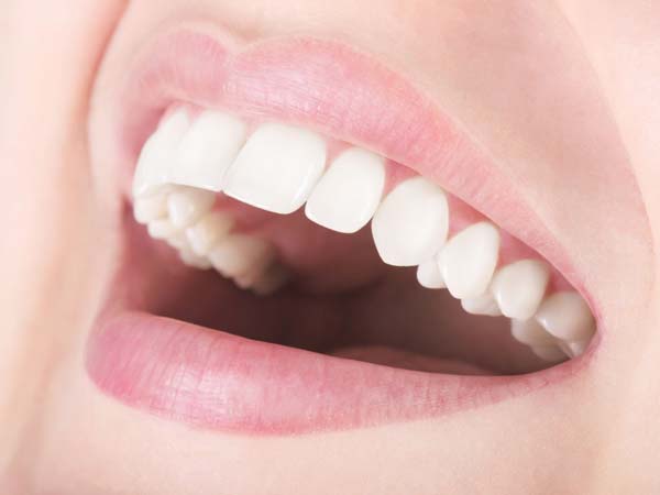 عوارض ونیر کامپوزیت دندان
