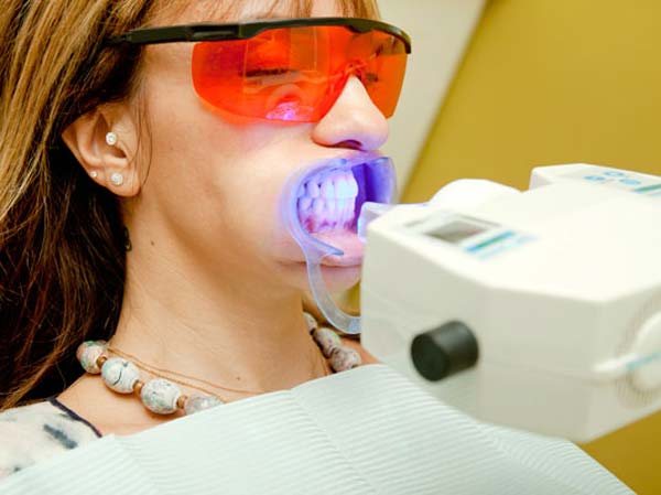 روش سفید کردن دندان ها در مطب (office bleaching)