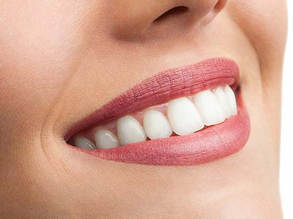 میزان تراش دندان در لمینت سرامیکی